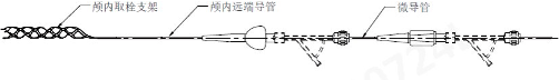 支架型取栓协同系统（暂未获证）